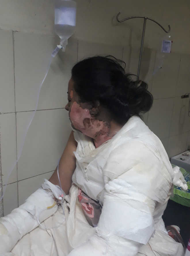 Mani Majra woman set on fire with Kerosene, accuses family