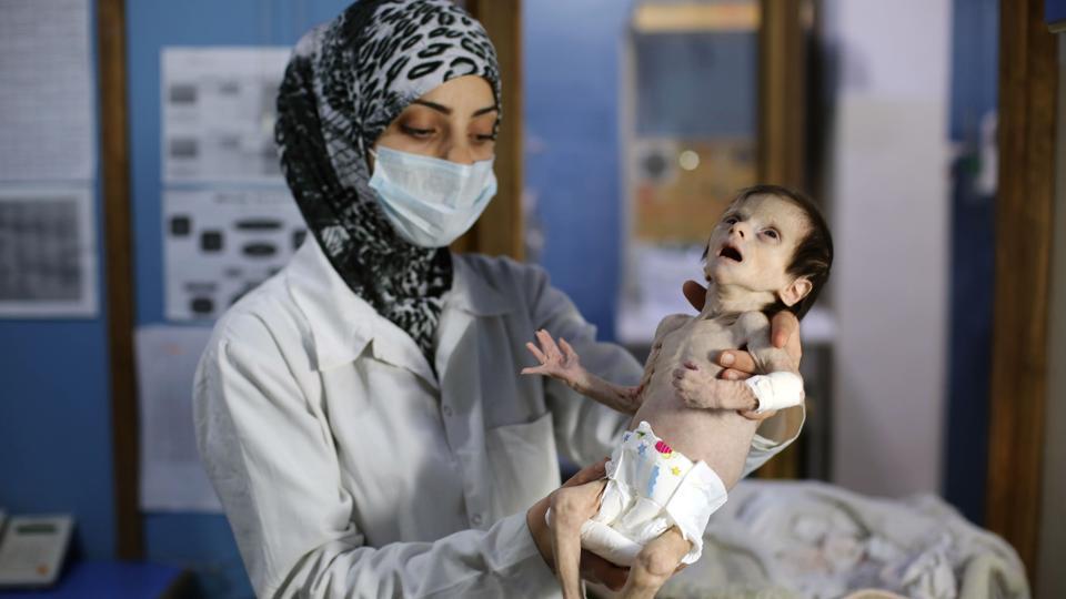 Paying the Price of War: An innocent malnourished Syrian baby died of hunger