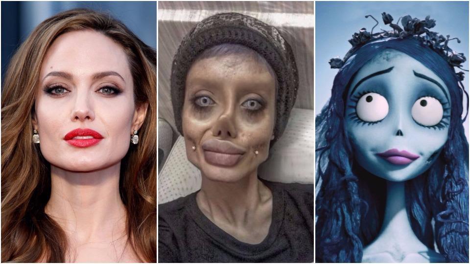 Woman undergoes 50 surgeries, losses 40 Kg to look like Angelina Jolie