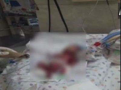 Max Hospital: Baby wrongly declared dead last week by hospital dies