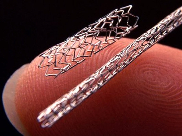 Govt revises prices of coronary stents; applicable from Today
