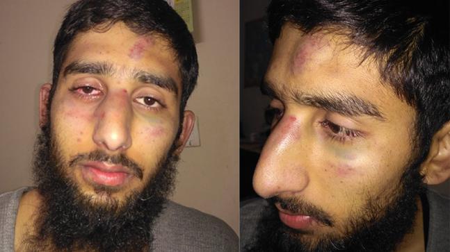 Kashmiri youth assault in Haryana: Police Arrest Three Accused