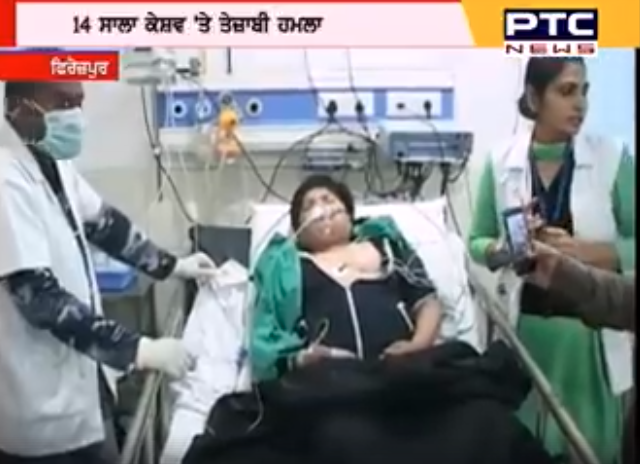 Acid Attack on a 14 year old boy in Ferozepur, Punjab in broad day light