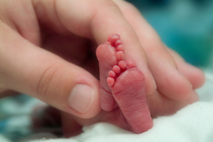 Doctor slashes genitals of newborn to prove he was born girl