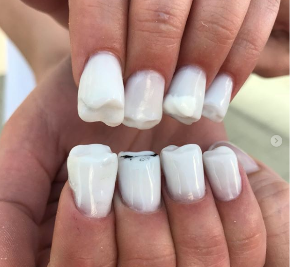 Yay or Nay? Molar Nails Are a Thing on the internet these days!