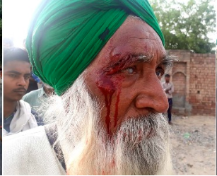 Farmer injured during the ongoing protest in Punjab