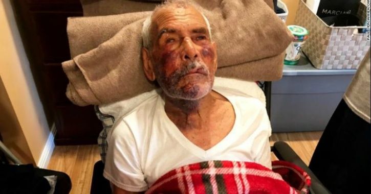 Racial attack: 91-year-old man thrashed with brick