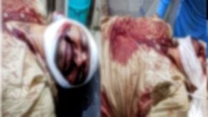 Bathinda: Akali worker On Attack Harsimrat Kaur Badal reached hospital