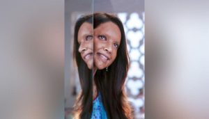 Big Breaking : Deepika Padukone Acid victims Will celebrate 34th birthday