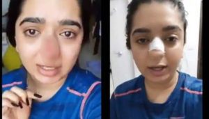 Woman Allegedly Attacked By Zomato Delivery Guy In Bangalore
