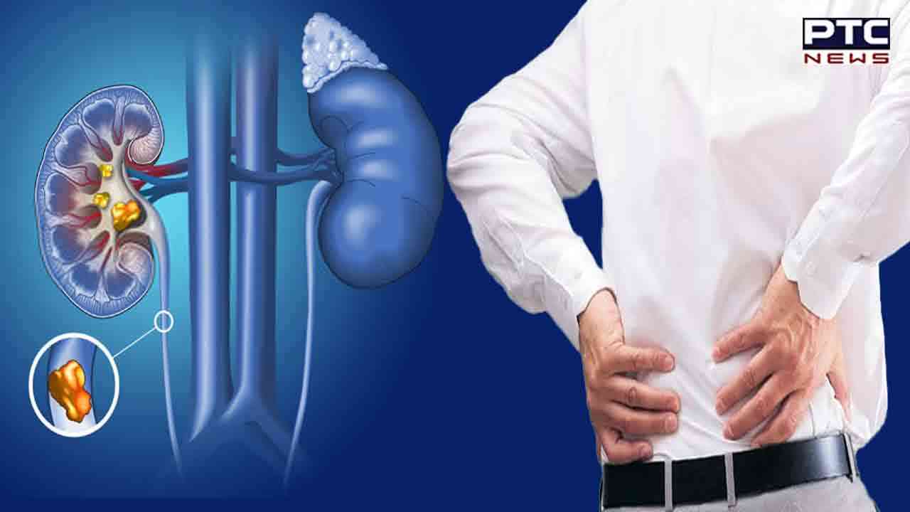 ਪਿਸ਼ਾਬ ਵਿੱਚ ਖੂਨ ਗੁਰਦੇ ਵਿੱਚ 'Blood Clotting' ਦਾ ਹੋ ਸਕਦਾ ਸੰਕੇਤ