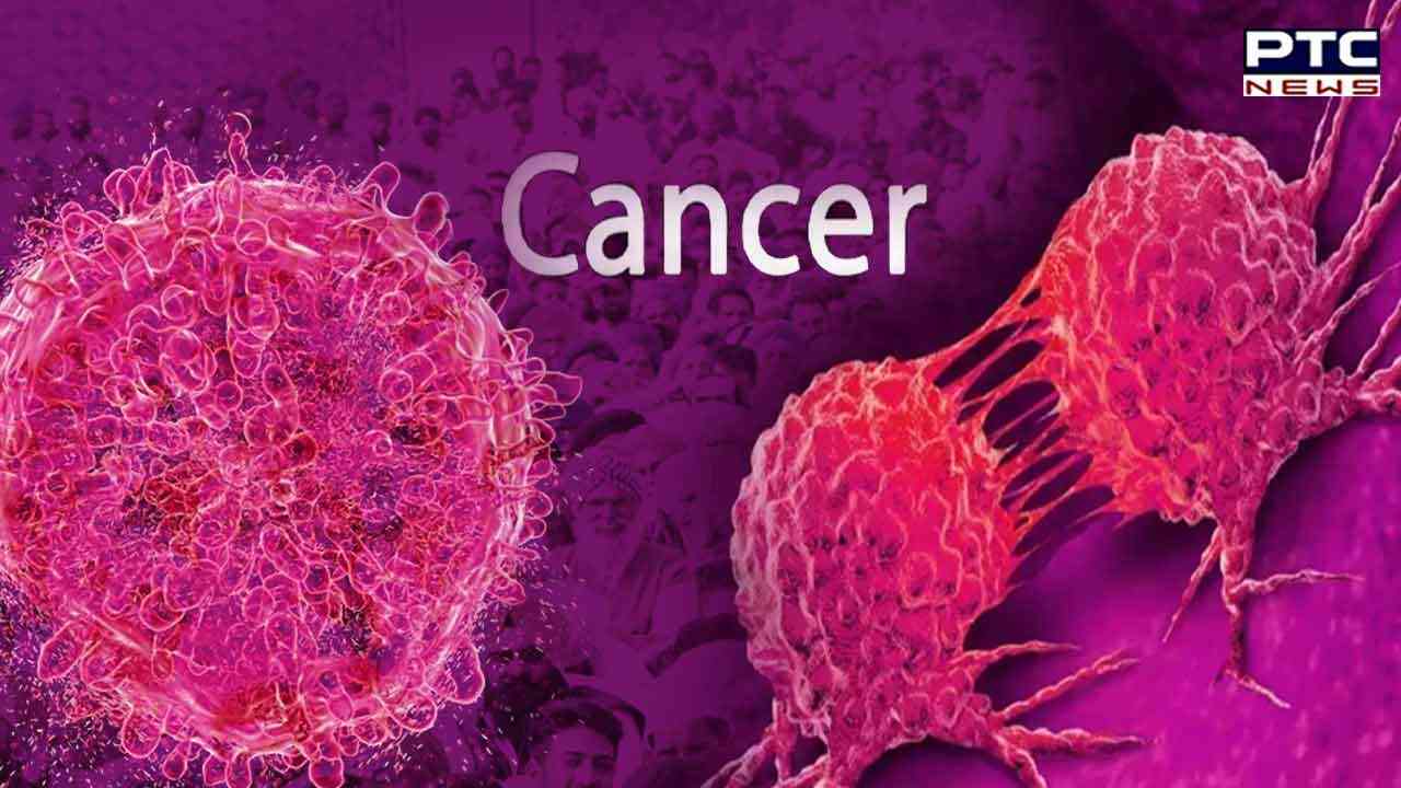 Cancer cases rise in Punjab; 30-plus age category most affected