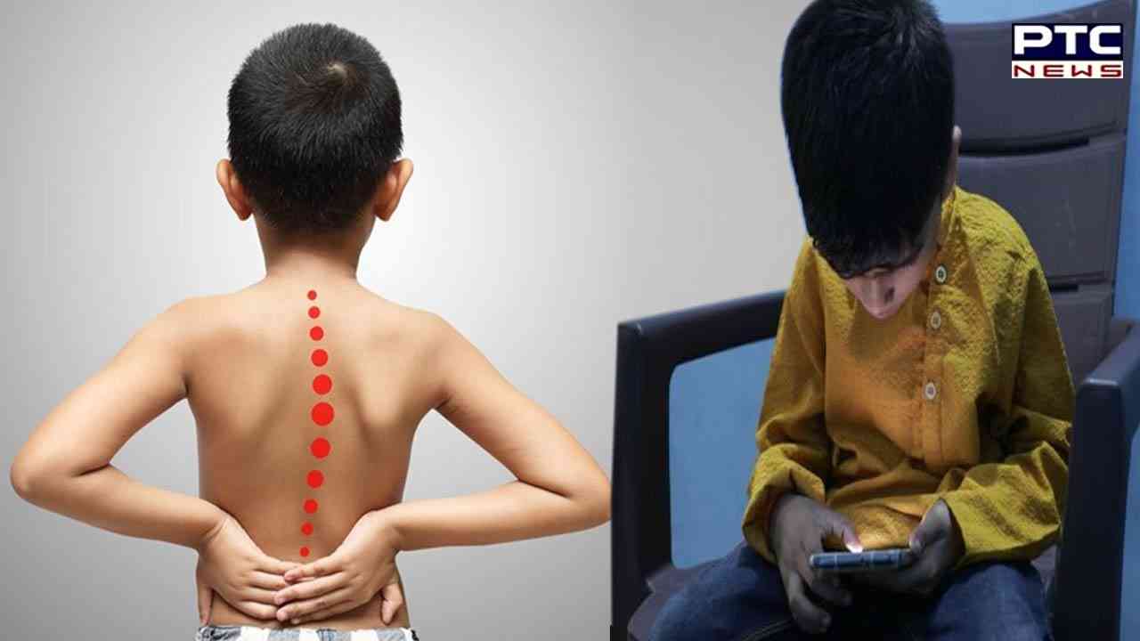 Using smartphone for over 3 hours a day can break your back!