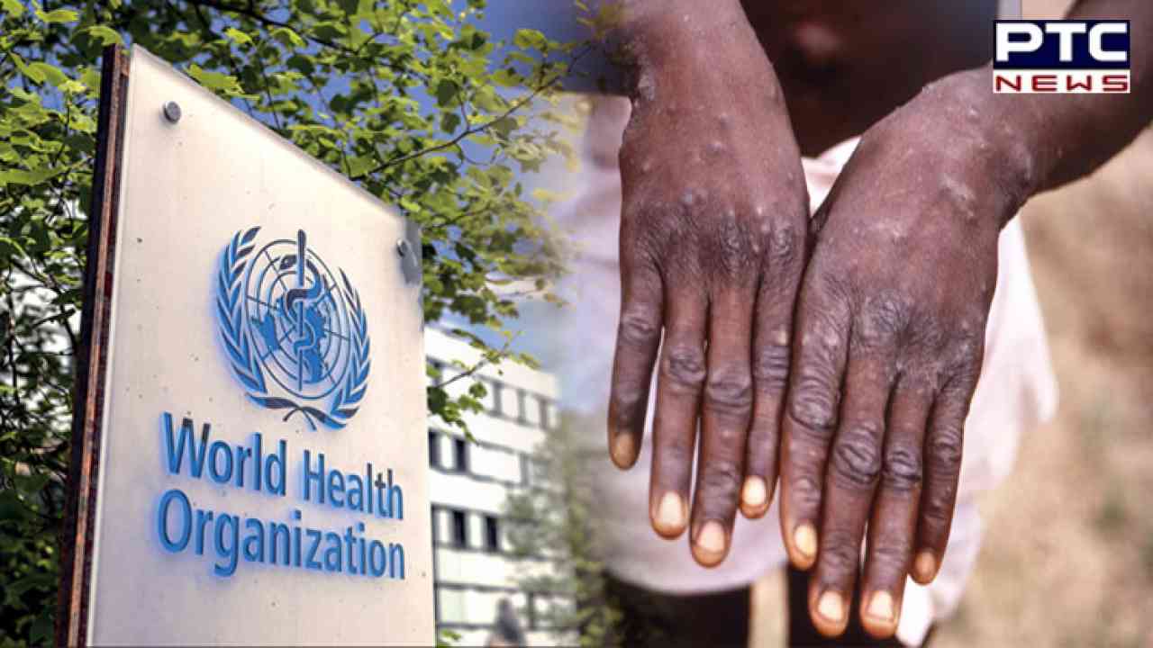 Monkeypox no longer a global health emergency: WHO