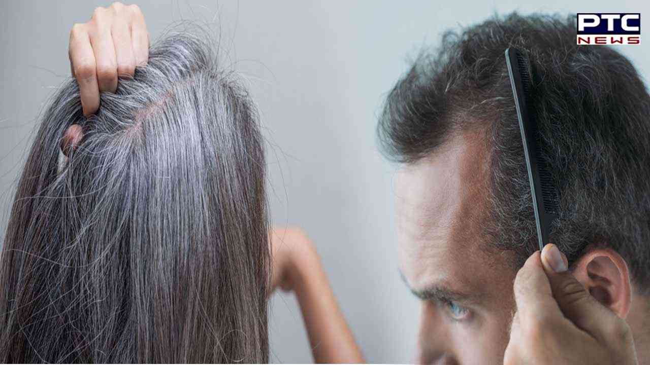 Try these home remedies to help slow down greying of hair