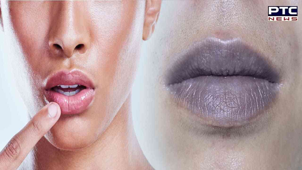 Dark Upper Lips Home Remedies : ਕੀ ਤੁਸੀਂ ਵੀ ਪਰੇਸ਼ਾਨ ਹੋ ਆਪਣੇ ਬੁੱਲ੍ਹਾਂ ਦੇ ਕਾਲੇਪਨ ਨੂੰ ਲੈ ਕੇ ਤਾਂ ਇਹ ਖ਼ਬਰ ਹੈ ਤੁਹਾਡੇ ਲਈ...
