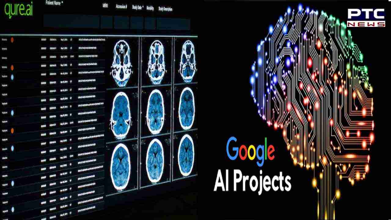 Google AI : ਹੁਣ ਤੁਹਾਡੇ ਫੋਨ ਕੈਮਰੇ ਤੋਂ ਖਿੱਚੀ ਤਸਵੀਰ ਦੱਸੇਗੀ ਸ਼ਰੀਰ ਦੀ ਬਿਮਾਰੀ; ਨਹੀਂ ਪਵੇਗੀ MRI, X-Ray ਜਾਂ CT Scan ਦੀ ਲੋੜ