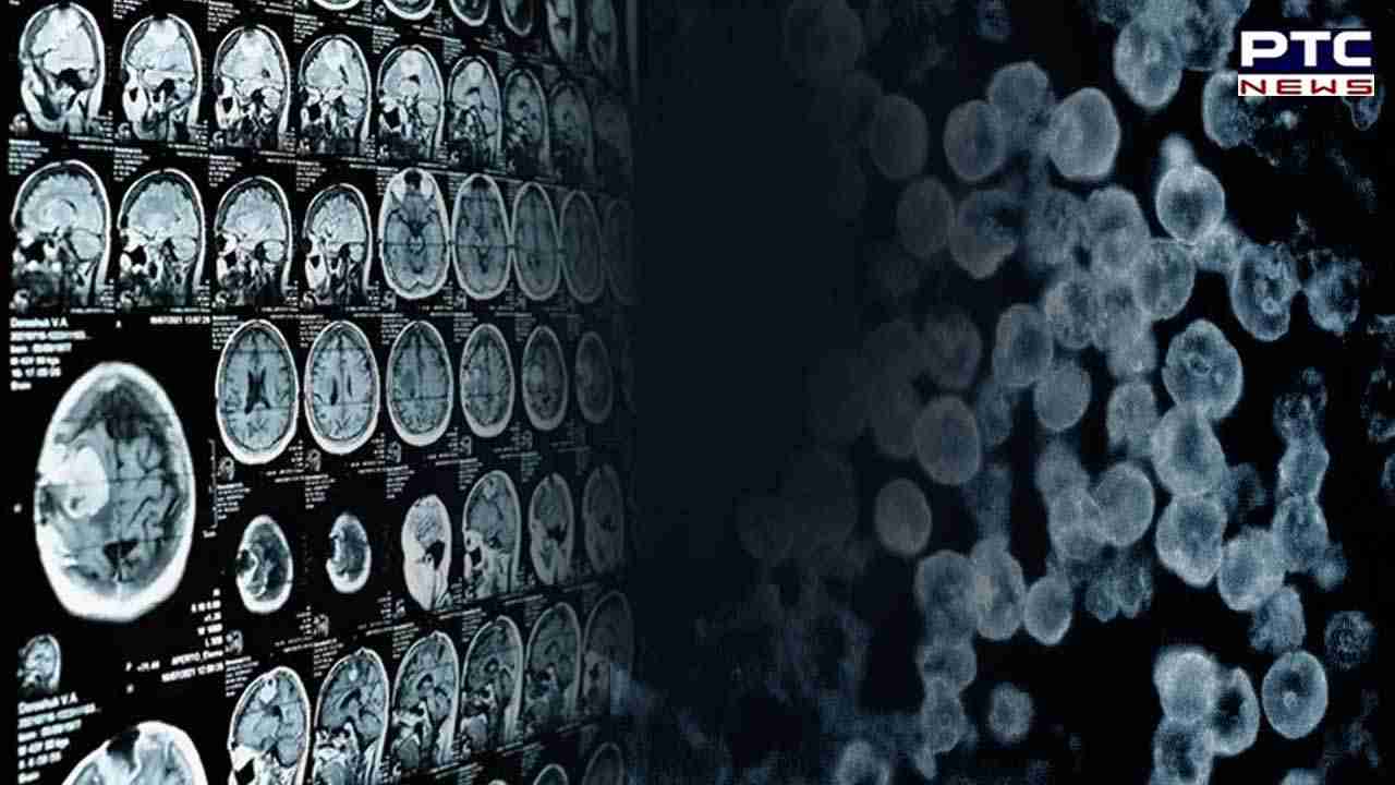 Tragic Fatality: Kerala teenager succumbs to rare brain infection from waterborne amoebae