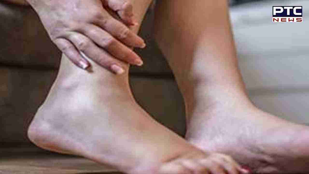 Home Remedies For Swelling: ਸੋਜ ਤੋਂ ਛੁਟਕਾਰਾ ਪਾਉਣ ਲਈ ਅਪਣਾਉ ਇਹ ਸ਼ਕਤੀਸ਼ਾਲੀ ਨੁਸਖੇ