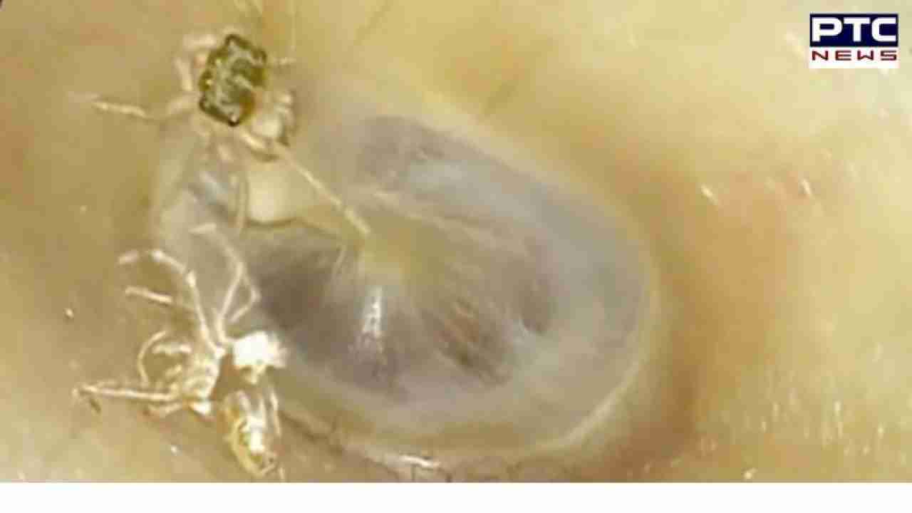 Spider found crawling in woman's ear; watch video