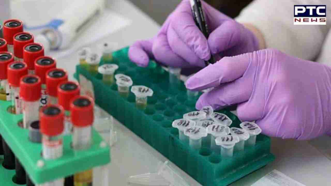 Emerging viruses uncovered in China spark worries about future pandemics