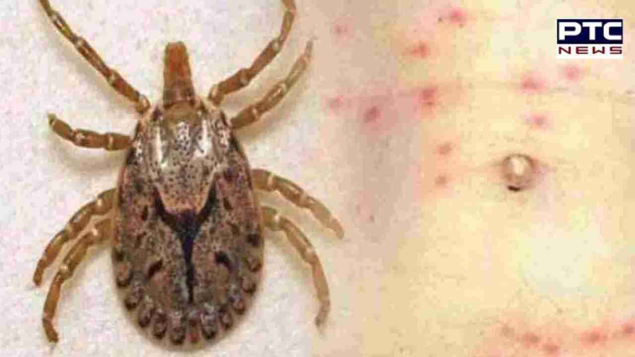 Scrub typhus: 8 die of scrub typhus in Odisha, testing intensified