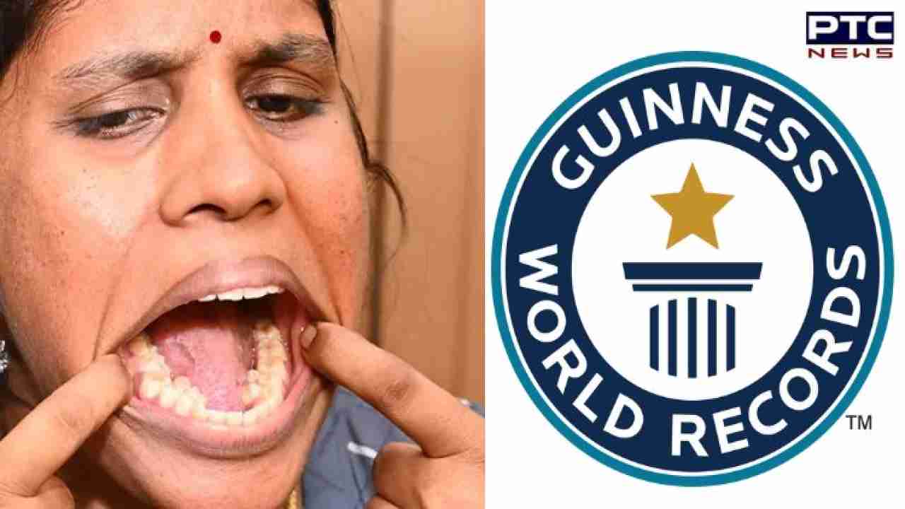 World Record for Teeths: Indian woman sets Guinness World Record for having most teeths