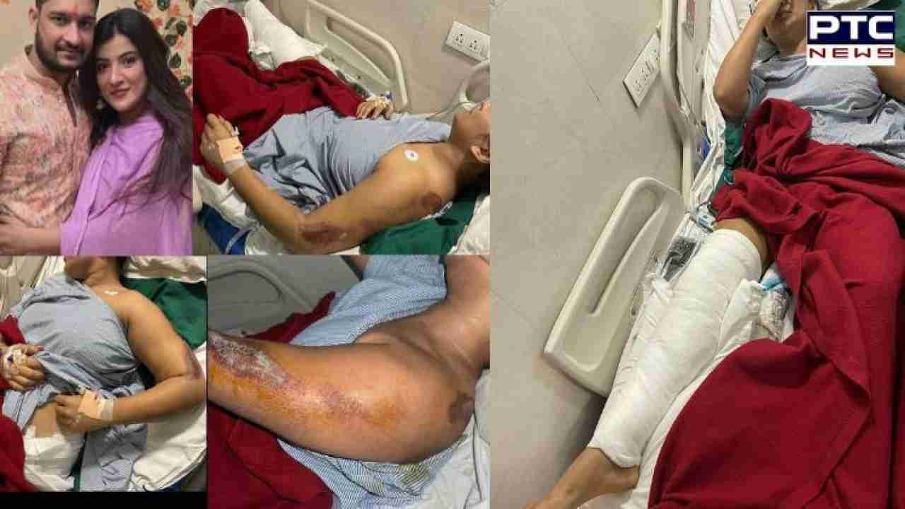 Mumbai horror | ‘Slapped, strangled, run over by car’ seriously injured girlfriend shares harrowing ordeal