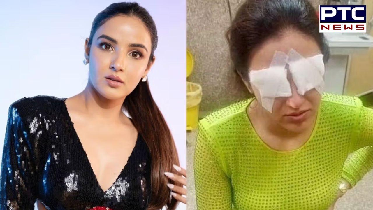 Jasmine Bhasin Eyes Damaged : ਇਸ ਮਸ਼ਹੂਰ ਅਦਾਕਾਰਾ ਨੂੰ ਦਿਖਣਾ ਹੋਇਆ ਬੰਦ, ਅੱਖਾਂ ਦਾ ਕੋਰਨੀਆ ਹੋਇਆ ਖਰਾਬ