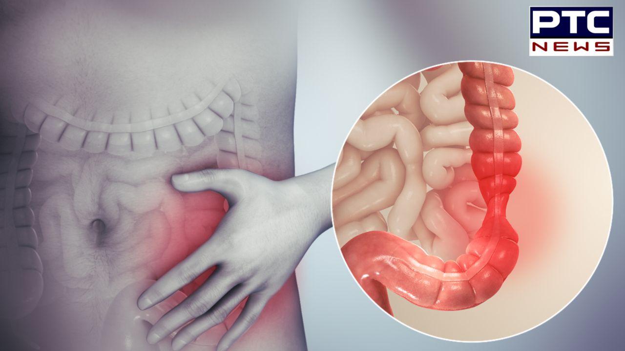 Irritable Bowel Syndrome : ਚਿੜਚਿੜਾ ਬੋਅਲ ਸਿੰਡਰੋਮ ਕੀ ਹੁੰਦਾ ਹੈ ? ਜਾਣੋ ਇਸ ਦੇ ਲੱਛਣ ਅਤੇ ਕਾਰਨ