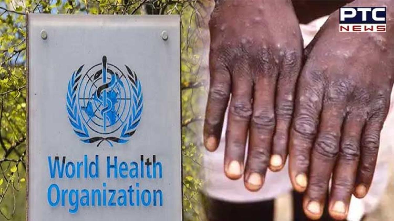 Surge in Monkeypox cases: WHO calls emergency meeting on mpox spread from Congo