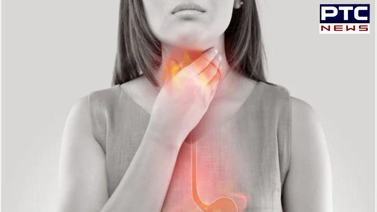 Acid Reflux :  ਐਸਿਡ ਰਿਫਲਕਸ ਦੀ ਸਮੱਸਿਆ ਕਿਉਂ ਹੁੰਦੀ ਹੈ? ਜਾਣੋ ਇਸ 'ਤੋਂ ਛੁਟਕਾਰਾ ਪਾਉਣ ਦੇ ਤਰੀਕੇ