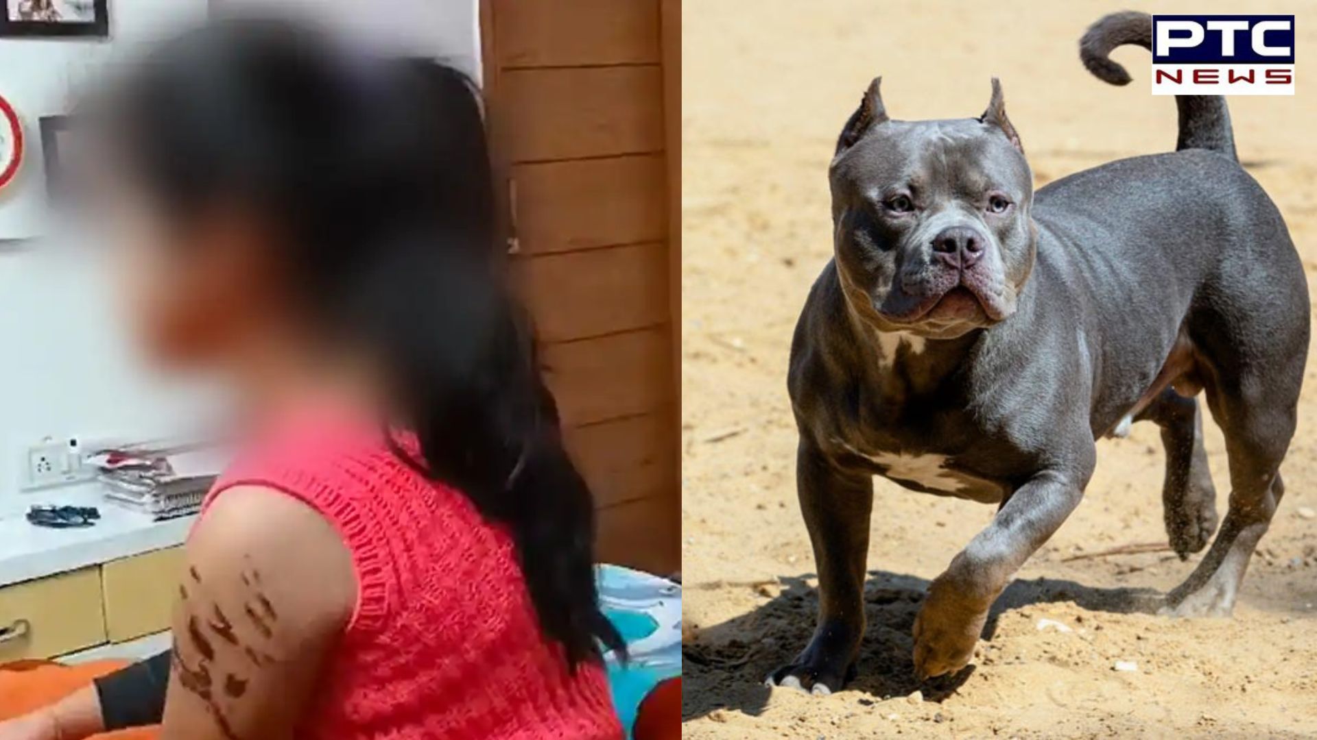 Delhi tragedy: 7-year-old girl receives 15 injuries after American Bully dog attack