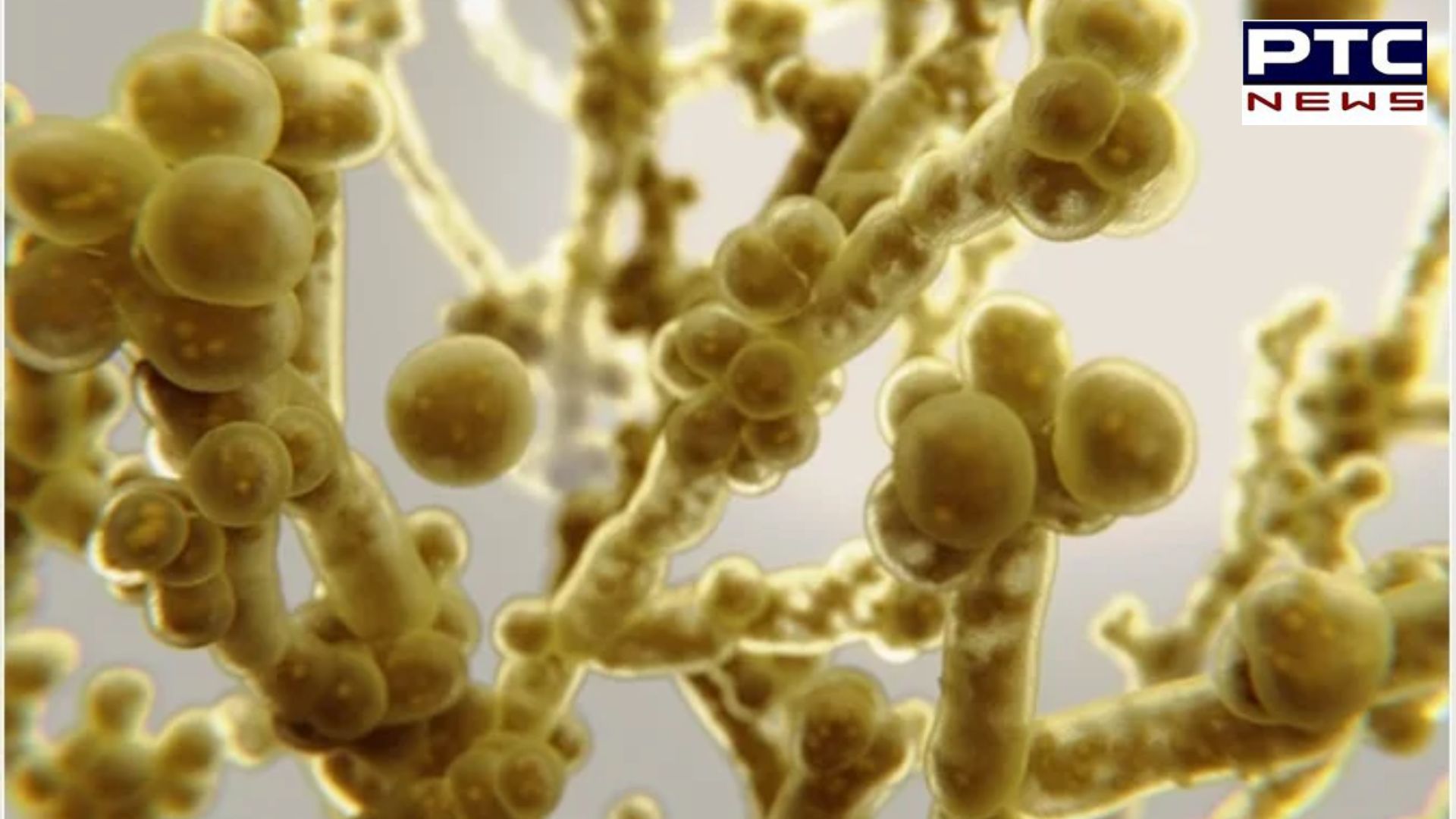 What is Candida Auris – Types, symptoms, treatment & prevention