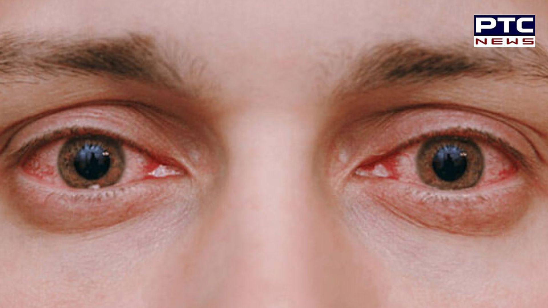 ਅੱਖਾਂ ਦੀਆਂ ਸਮੱਸਿਆਵਾਂ ਦੇ ਇਨ੍ਹਾਂ ਲੱਛਣਾਂ ਨੂੰ ਨਜ਼ਰਅੰਦਾਜ਼ ਕਰਨਾ ਪੈ ਸਕਦਾ ਹੈ ਮਹਿੰਗਾ, ਜਾਣੋ ਕਿਵੇਂ ਕਰੀਏ ਬਚਾਅ