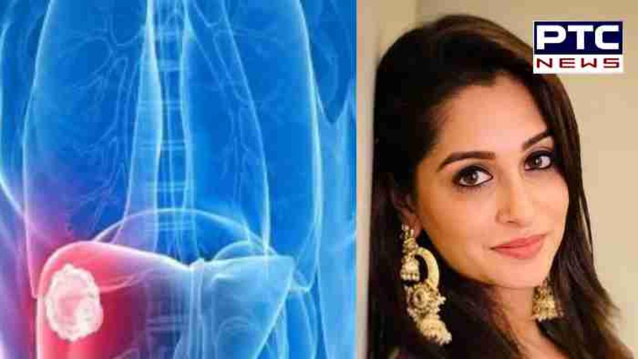 Dipika Kakar cancer : ਦੀਪਿਕਾ ਕੱਕੜ ਨੂੰ ਹੋਇਆ ਸਟੇਜ 2 ਲੀਵਰ ਕੈਂਸਰ ,ਵੀਡੀਓ ਸ਼ੇਅਰ ਕਰ ਦਿੱਤੀ ਪ੍ਰਸ਼ੰਸਕਾਂ ਨੂੰ ਜਾਣਕਾਰੀ