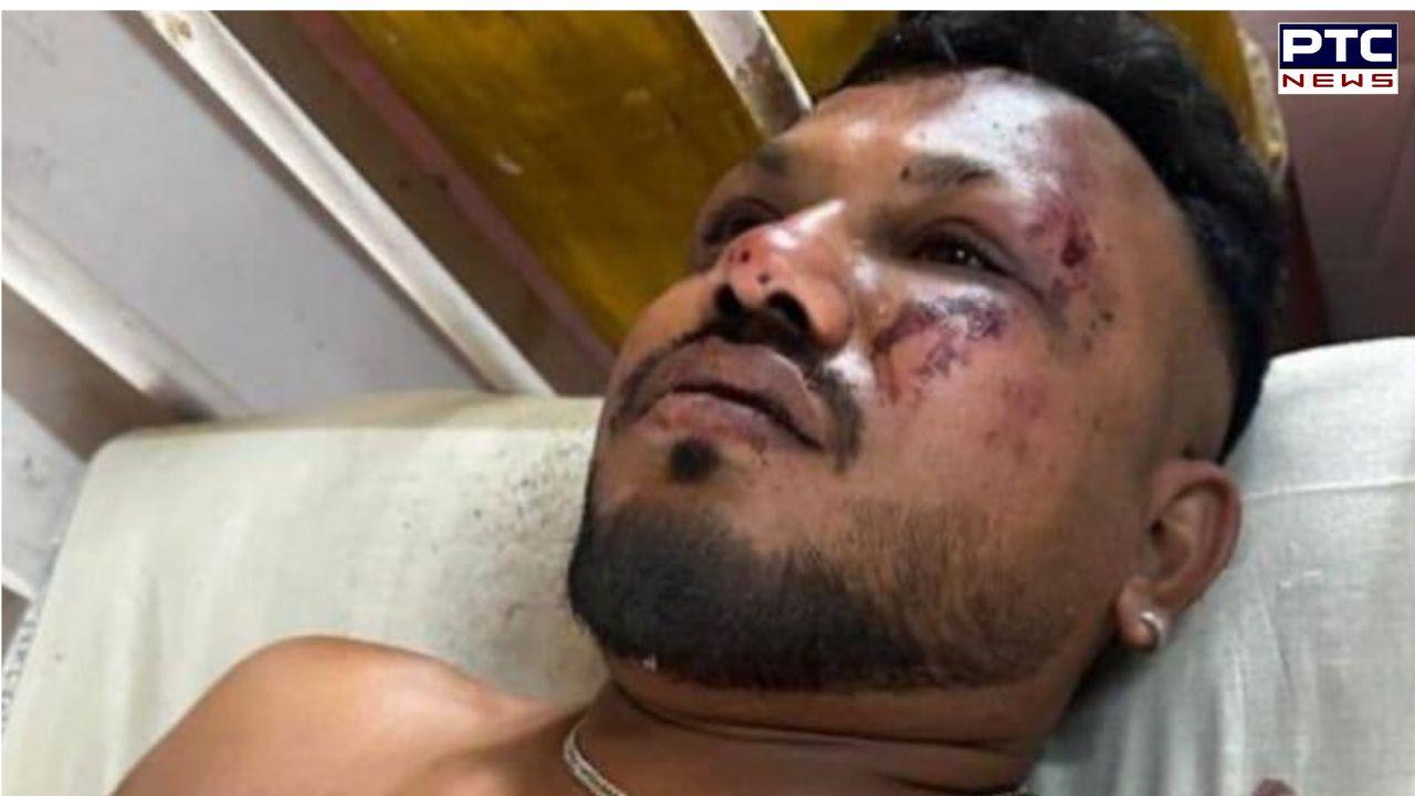 Air India plane crash: 40-year-old Vishwash Kumar Ramesh from UK survives crash, his brother missing