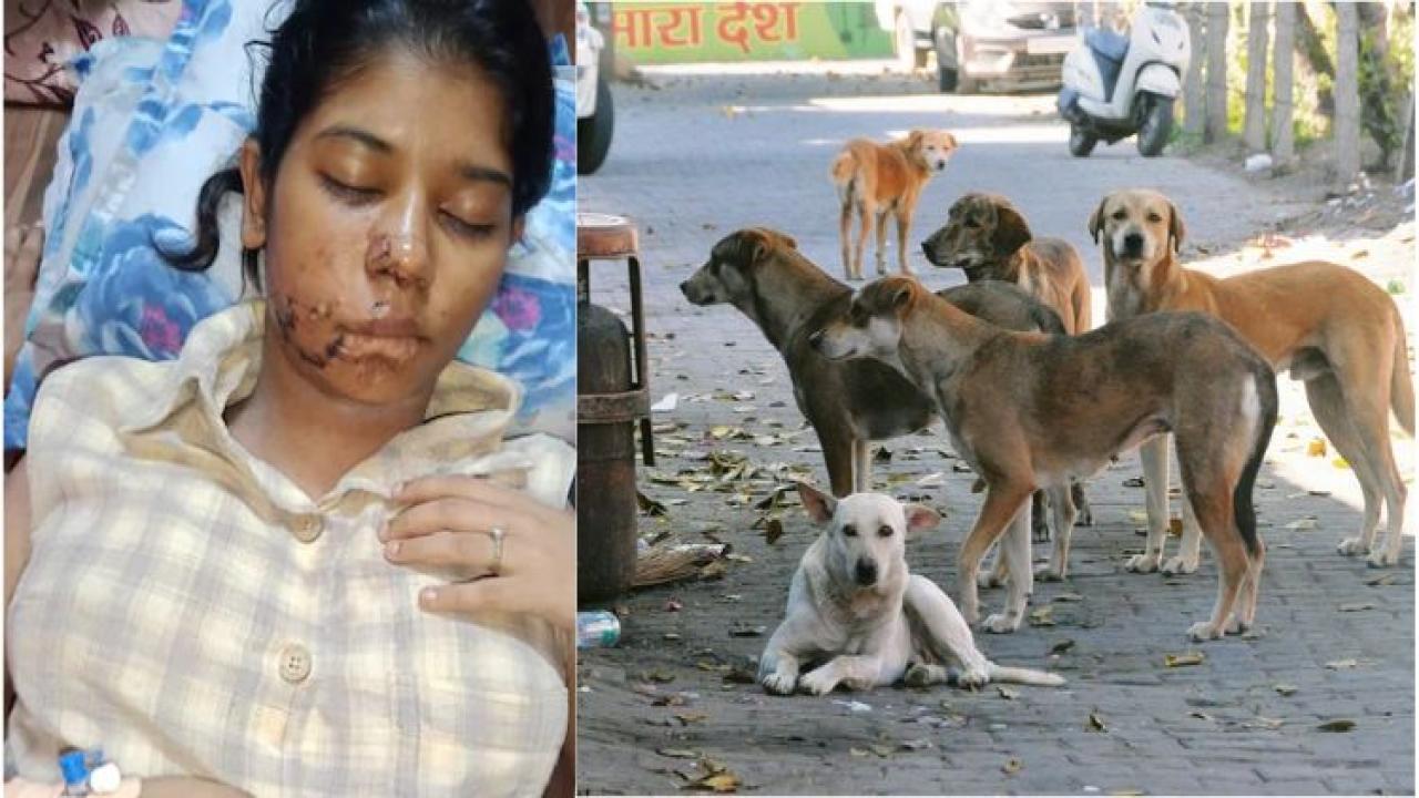 21-year-old college student mauled by stray dogs in Kanpur, suffers 17 stiches on cheek and nose