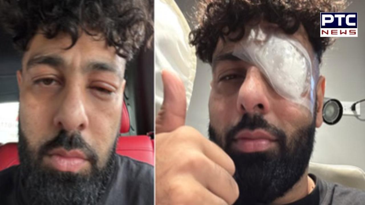 Rapper ਬਾਦਸ਼ਾਹ ਦੀ ਅੱਖ 'ਤੇ ਲੱਗੀ ਸੱਟ ,ਇੰਸਟਾਗ੍ਰਾਮ 'ਤੇ ਸਾਂਝੀਆਂ ਕੀਤੀਆਂ ਤਸਵੀਰਾਂ , ਫ਼ੈਨਜ ਵੀ ਹੋਏ ਪ੍ਰੇਸ਼ਾਨ