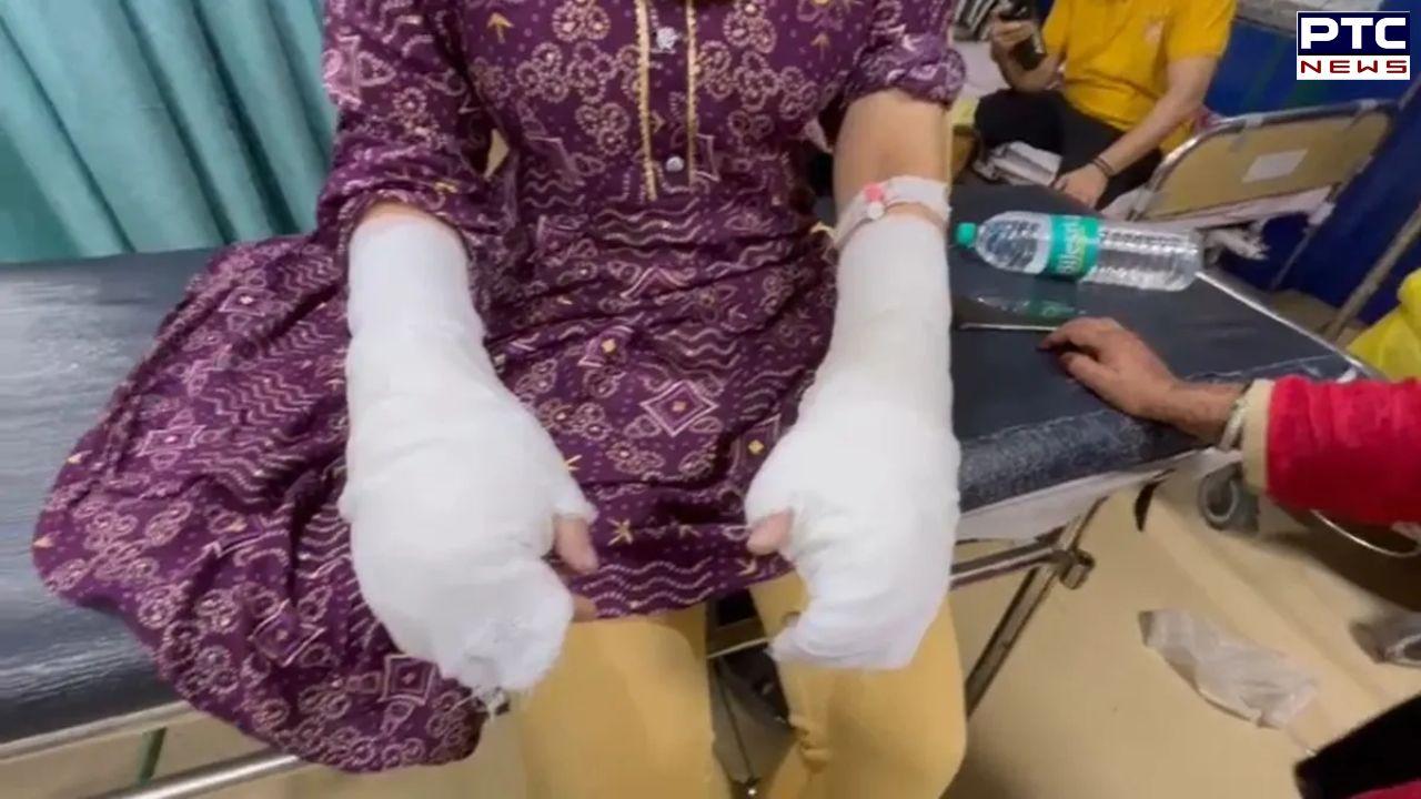 Delhi ’ਚ DU ਦੀ ਵਿਦਿਆਰਥਣ ਤੇਜ਼ਾਬੀ ਹਮਲੇ ਦਾ ਸ਼ਿਕਾਰ, ਕਾਲਜ ਜਾਂਦੇ ਸਮੇਂ ਵਾਪਰੀ ਰੂਹ ਕੰਬਾਉ ਘਟਨਾ