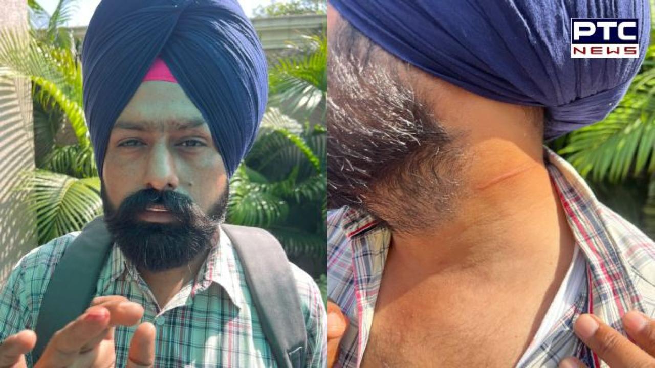 Amritsar News : ਚਾਈਨਾ ਡੋਰ ਦੀ ਲਪੇਟ 'ਚ ਆਇਆ ਸ਼ਖ਼ਸ, ਦਫ਼ਤਰ ਜਾ ਰਿਹਾ ਨੌਜਵਾਨ ਹੋਇਆ ਜ਼ਖਮੀ