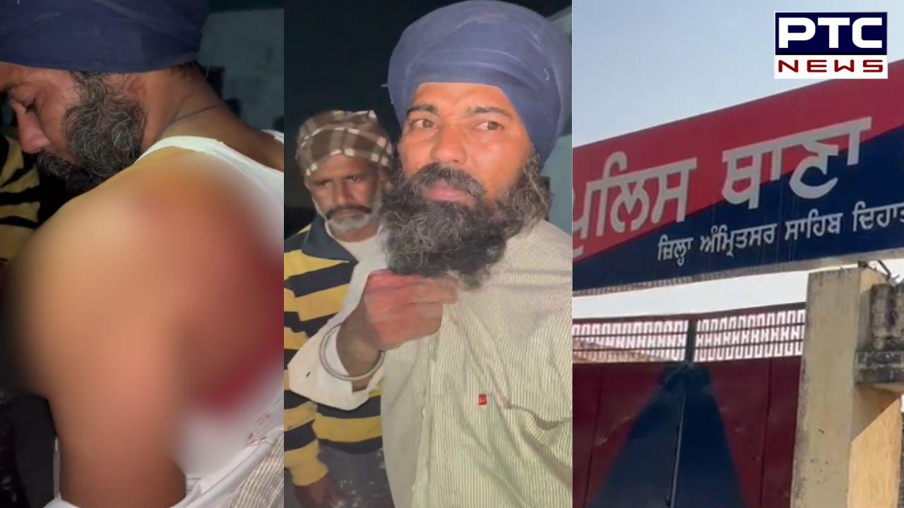 Amritsar Firing News : ਗੁਰੂ ਨਗਰੀ ਅੰਮ੍ਰਿਤਸਰ ’ਚ ਚੱਲੀਆਂ ਗੋਲੀਆਂ, ਨਸ਼ਾ ਵੇਚਣ ਤੋਂ ਰੋਕਣ ’ਤੇ ਨੌਜਵਾਨ ’ਤੇ ਹਮਲਾ