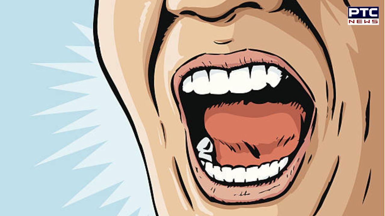 Molestation Case : ਮੁੰਡੇ ਨੂੰ ਕੁੜੀ ਨਾਲ ਜ਼ਬਰਦਸਤੀ ਪਈ ਮਹਿੰਗੀ, ਸਾਬਕਾ ਪ੍ਰੇਮਿਕਾ ਨੇ ਦੰਦਾਂ ਨਾਲ ਜੀਭ ਦੇ ਕੀਤੇ ਦੋ ਟੁਕੜੇ