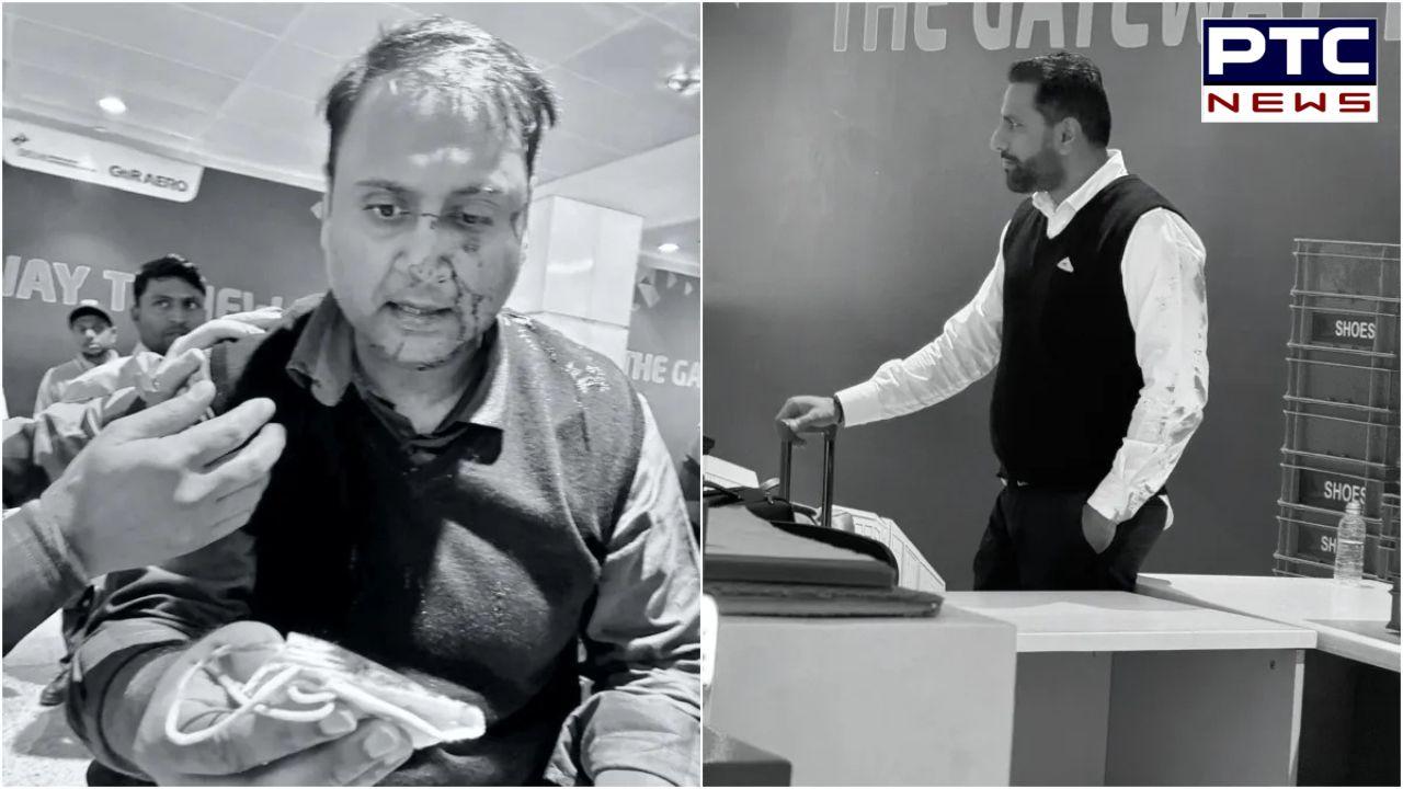 Left me bleeding: Passenger claims assault by Air India pilot, airline responds