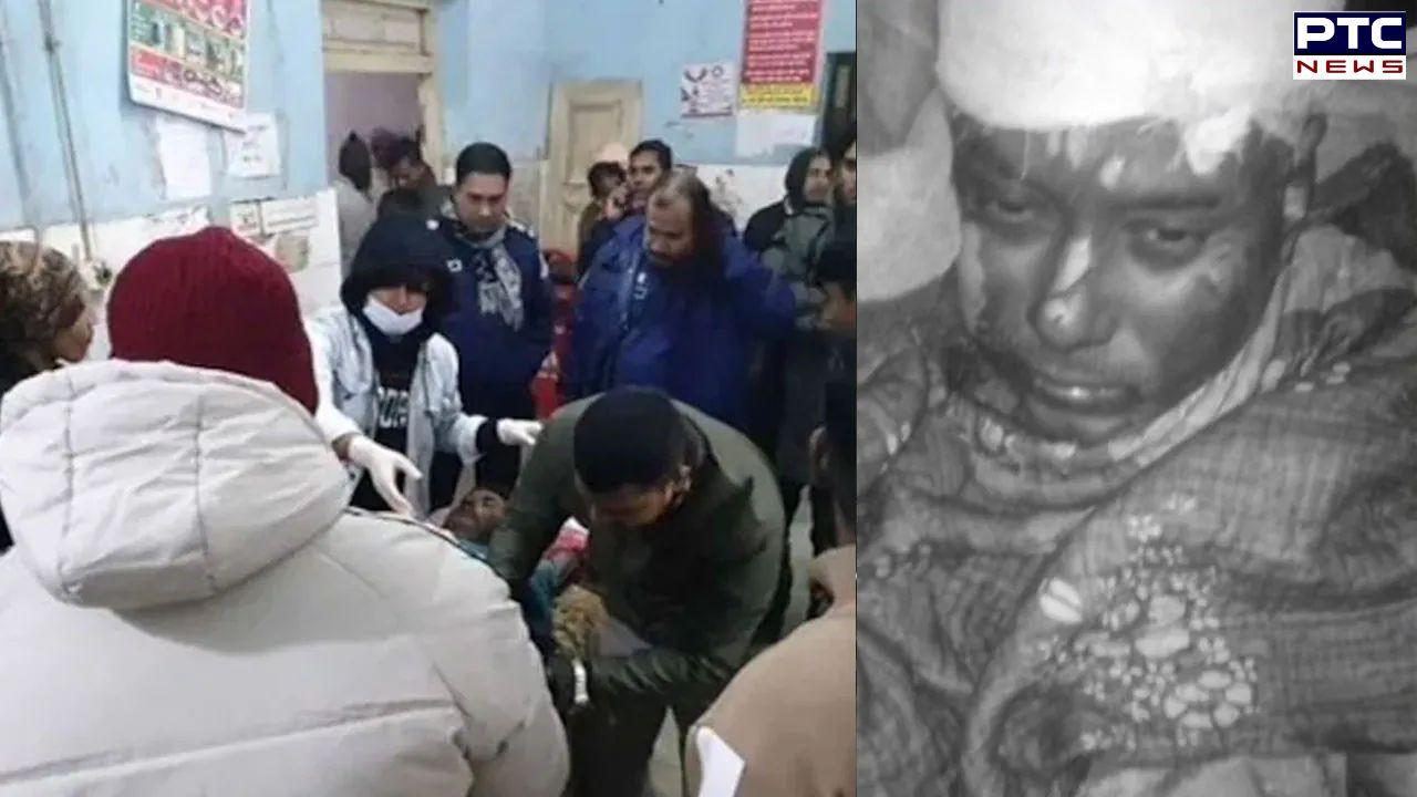 Hindu man who was attacked, set on fire in Bangladesh dies; fourth killing in two months