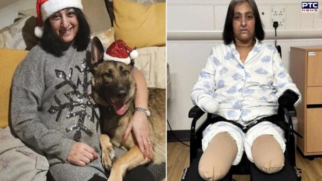 UK-based Punjabi woman loses all four limbs to sepsis after suspected dog infection, returns home after 32-week battle
