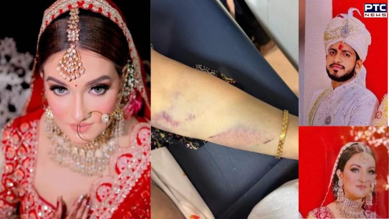 Greater Noida woman dies after falling from third-floor balcony; husband, father-in-law arrested over dowry harassment allegations