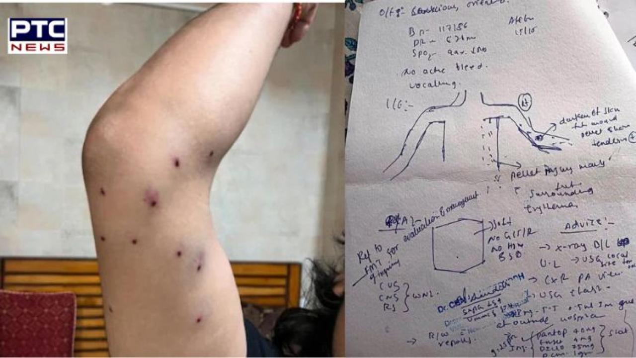 Jantar Mantar protest: Hospital records 'pellet wounds' on protester, Delhi Police deny using pellet guns