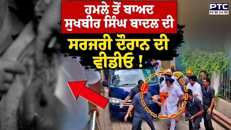 Sukhbir Singh Badal ਦੀ ਸਰਜਰੀ ਦੌਰਾਨ ਦੀ ਵੀਡੀਓ, ਨਾਂਦੇੜ ਸਾਹਿਬ ਵਿਖੇ ਹੋਇਆ ਸੀ ਜਾਨਲੇਵਾ ਹਮਲਾ